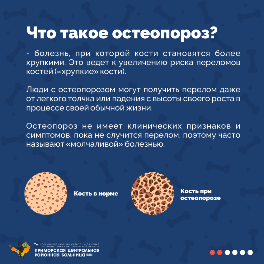 Остеопороз_2.png Остеопороз_2.png